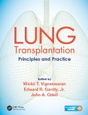 Lung Transplantation (eBook, ePUB)