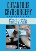 Cutaneous Cryosurgery (eBook, ePUB)