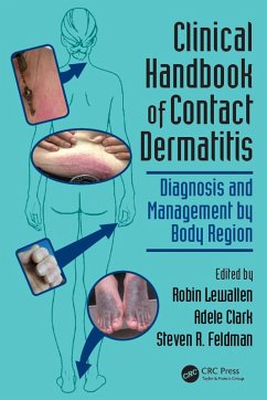 Clinical Handbook of Contact Dermatitis (eBook, PDF)