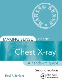 Making Sense of the Chest X-ray (eBook, PDF) - Jenkins, Paul