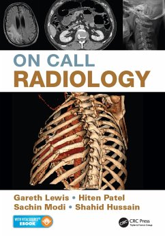 On Call Radiology (eBook, PDF) - Lewis, Gareth; Modi, Sachin; Patel, Hiten; Hussain, Shahid