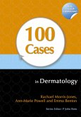 100 Cases in Dermatology (eBook, PDF)