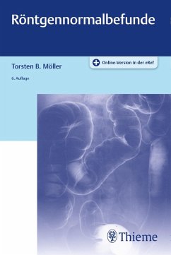 Röntgennormalbefunde (eBook, PDF) - Möller, Torsten Bert