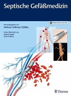 Septische Gefäßmedizin (eBook, PDF)