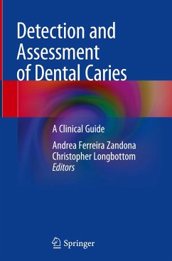 Detection and Assessment of Dental Caries