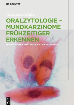 Oralzytologie - Mundkarzinome frühzeitiger erkennen Cover Oralzytologie - Mundkarzinome frühzeitiger erkennen