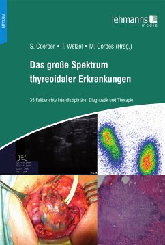 Das große Spektrum thyreoidaler Erkrankungen (eBook, PDF)