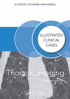 Thoracic Imaging (eBook, ePUB) - Copley, Sue; Hansell, David; Kanne, Jeffrey