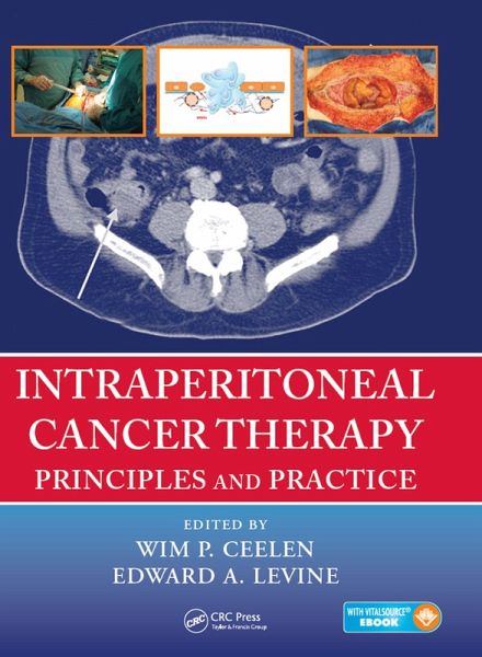 Intraperitoneal Cancer Therapy (eBook, ePUB)