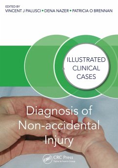 Diagnosis of Non-accidental Injury (eBook, ePUB)