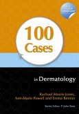 100 Cases in Dermatology (eBook, ePUB)