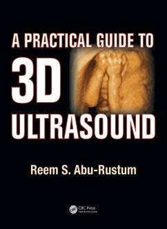 A Practical Guide to 3D Ultrasound (eBook, ePUB) - Abu-Rustum, Reem S.