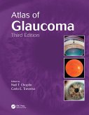 Atlas of Glaucoma (eBook, ePUB)