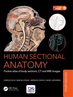 Human Sectional Anatomy (eBook, ePUB) - Dixon, Adrian Kendal; Bowden, David J.; Logan, Bari M.; Ellis, Harold