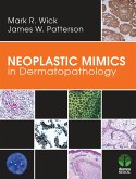 Neoplastic Mimics in Dermatopathology (eBook, ePUB)