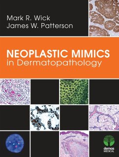 Cover Neoplastic Mimics in Dermatopathology (eBook, ePUB)