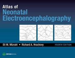 Atlas of Neonatal Electroencephalography (eBook, ePUB) - Hrachovy, Richard A.; Mizrahi, Eli M.