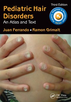 Pediatric Hair Disorders (eBook, ePUB) - Ferrando, Juan; Grimalt, Ramon