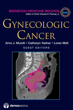 Cover Gynecologic Cancer (eBook, ePUB)