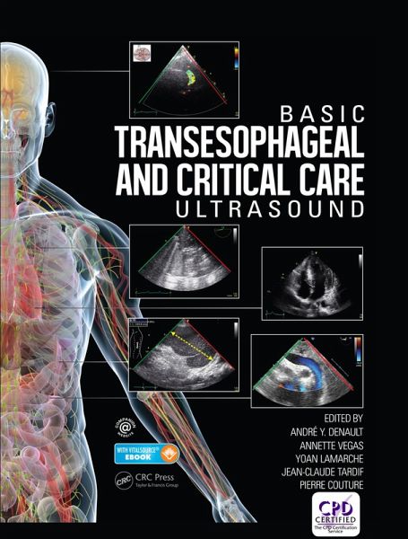 Basic Transesophageal and Critical Care Ultrasound (eBook, ePUB)
