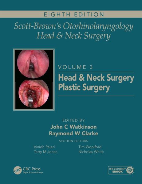Scott-Brown's Otorhinolaryngology and Head and Neck Surgery (eBook, ePUB)