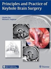 Principles and Practice of Keyhole Brain Surgery - Teo, Charles; Sughrue, Michael E.