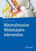 Minimalinvasive Wirbelsäulenintervention (eBook, PDF)