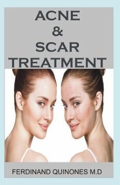 Acne & Scar Treatment: All You Need to about Curing Acne with Ease, Quickly and Naturally. - Quinones MD, Ferdinand