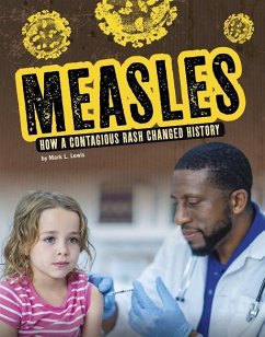 Measles: How a Contagious Rash Changed History - Lewis, Mark K.