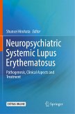 Neuropsychiatric Systemic Lupus Erythematosus