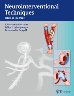 Neurointerventional Techniques - Gonzalez, Fernando; Albuquerque, Felipe; McDougall, Cameron G