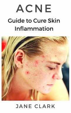 Acne: Guide to Cure Skin Inflammation - Clark, Jane