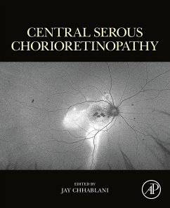 Central Serous Chorioretinopathy (eBook, ePUB)