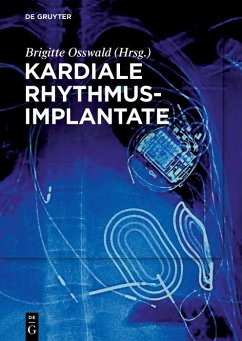 Kardiale Rhythmusimplantate (eBook, ePUB)