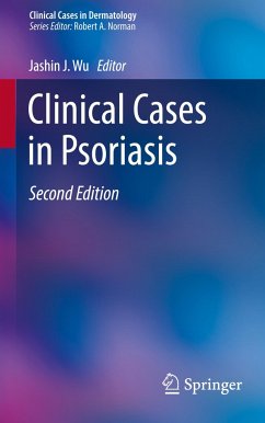 Clinical Cases in Psoriasis