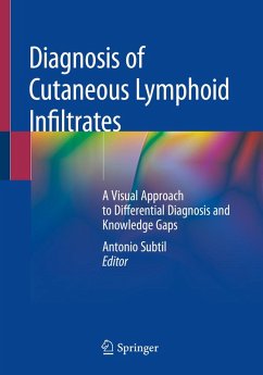 Diagnosis of Cutaneous Lymphoid Infiltrates (eBook, PDF) - Subtil, Antonio