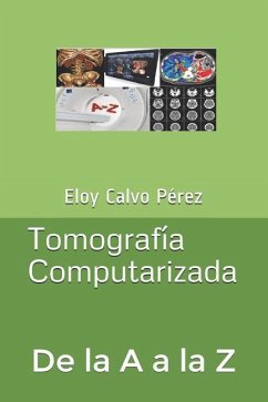 Tomografía Computarizada - Calvo Pérez, Eloy