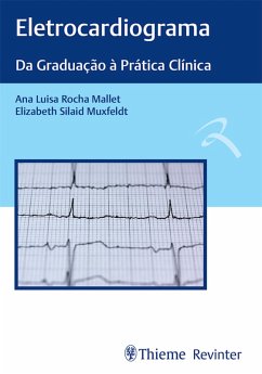 Eletrocardiograma (eBook, ePUB) - Mallet, Ana Luisa Rocha; Muxfeldt, Elizabeth Silaid