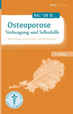 Osteoporose - Elies, Michael;Krüger, Eckard;Kerckhoff, Annette