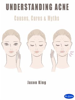 Understanding Acne (eBook, ePUB) - King, Jaxon