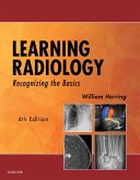 Learning Radiology (eBook, ePUB)