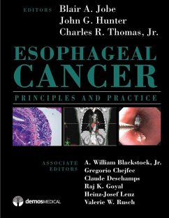 Cover Esophageal Cancer (eBook, ePUB)