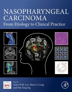 Cover Nasopharyngeal Carcinoma (eBook, ePUB)