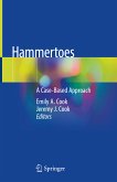 Hammertoes (eBook, PDF)