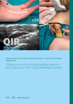 Ultrasound and clinically guided Injection techniques on the musculoskeletal system (eBook, ePUB)