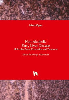 Non-Alcoholic Fatty Liver Disease