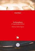 Arthroplasty