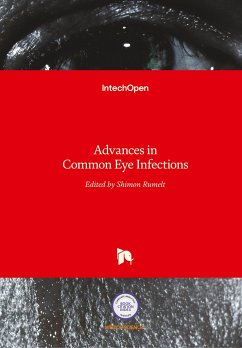 Advances in Common Eye Infections
