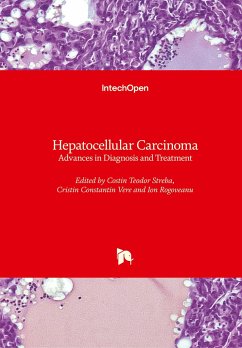 Hepatocellular Carcinoma