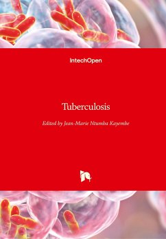 Tuberculosis